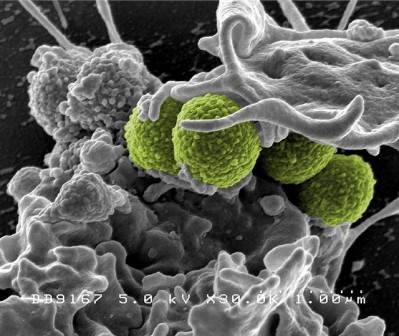 Antimicrobial peptides offer exciting potential for reducing the occurrence of antibiotic resistance. Photo courtesy of NIAID