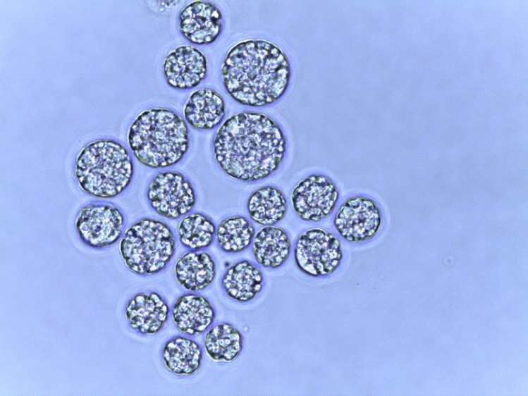 Marine microalgae of the strain Schizochytrium sp. © Veramaris 